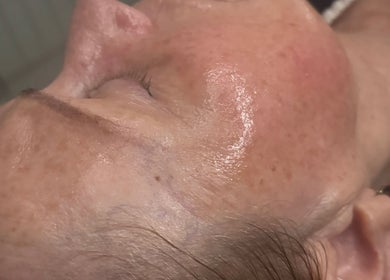 Close-up of a rejuvenating facial treatment at 11:11 Beauty and Aesthetics, Highbridge, England, GB.