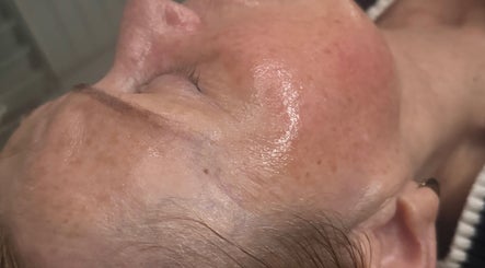 Close-up of a rejuvenating facial treatment at 11:11 Beauty and Aesthetics, Highbridge, England, GB.