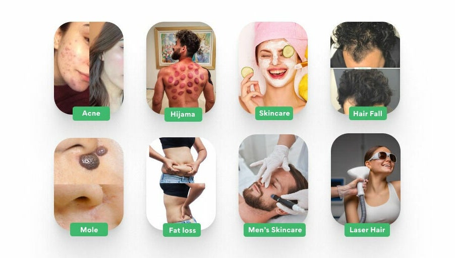 Alhadeh Best Hijama Centre Hyderabad image 1