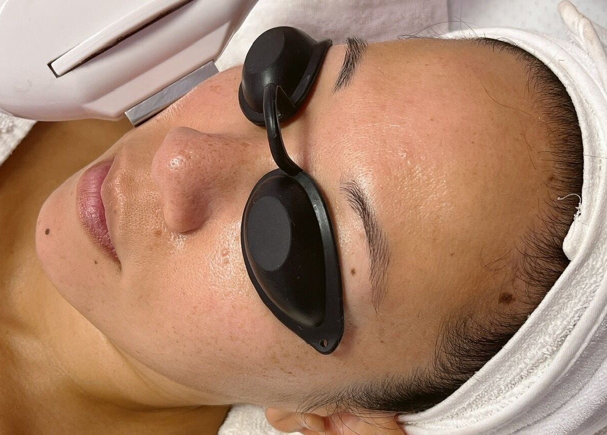 Facial treatment at Le Bon Skin Lab, New York. Client with goggles for skin rejuvenation.