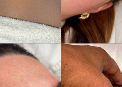 Close-up of healthy skin treatments at Bella Perfection Salon, Eglinton, Western Australia, AU.