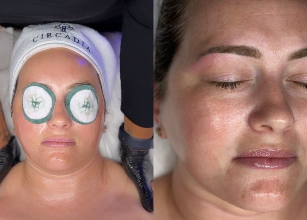 Facial treatment at Bella Perfection Salon, Eglinton, Western Australia, AU showcases therapeutic tranquility.