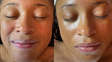 Esthestics Glow Skincare Lounge image 3