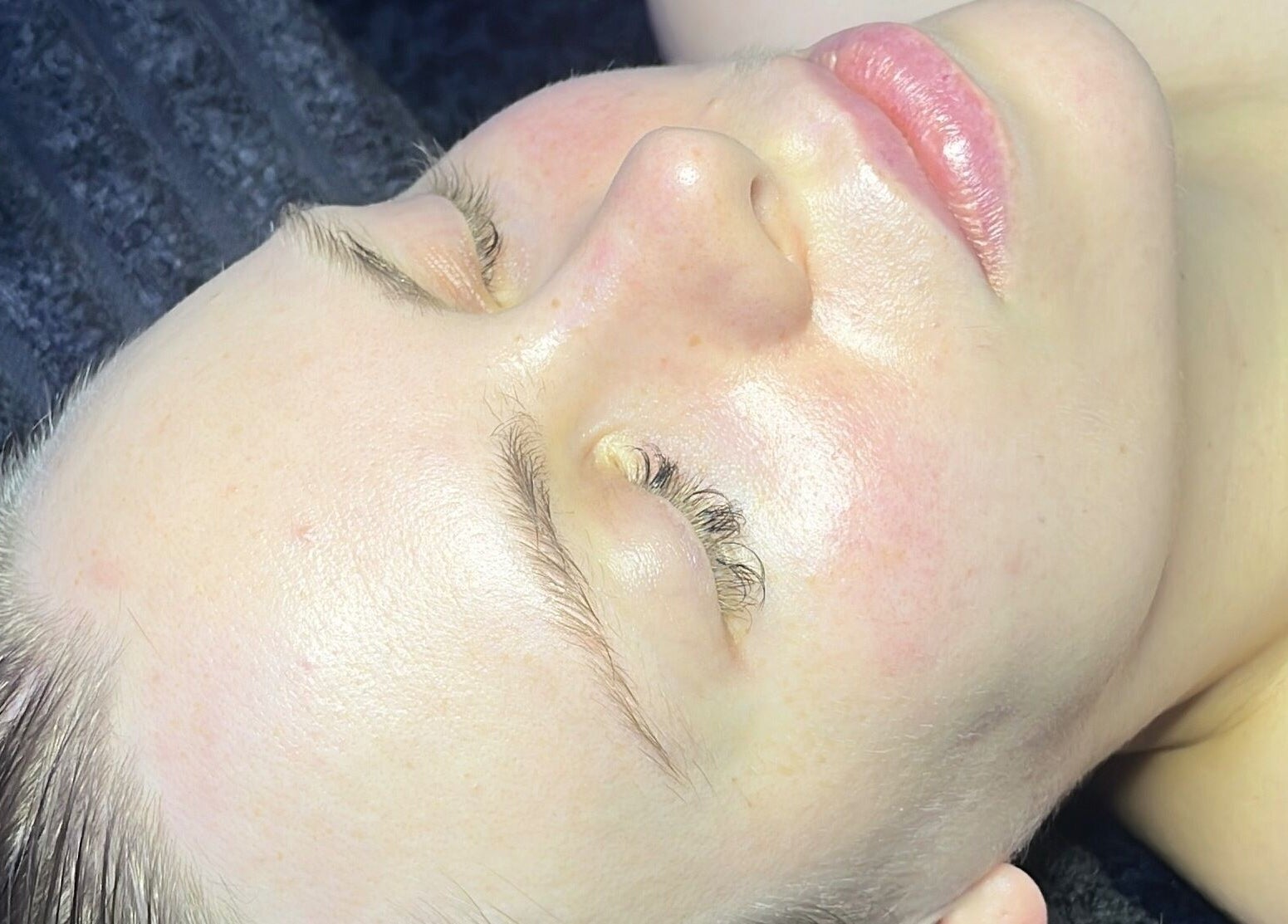 Close-up of a woman's radiant face post-treatment at Spasthetics, Newcastle-under-Lyme, England, GB.