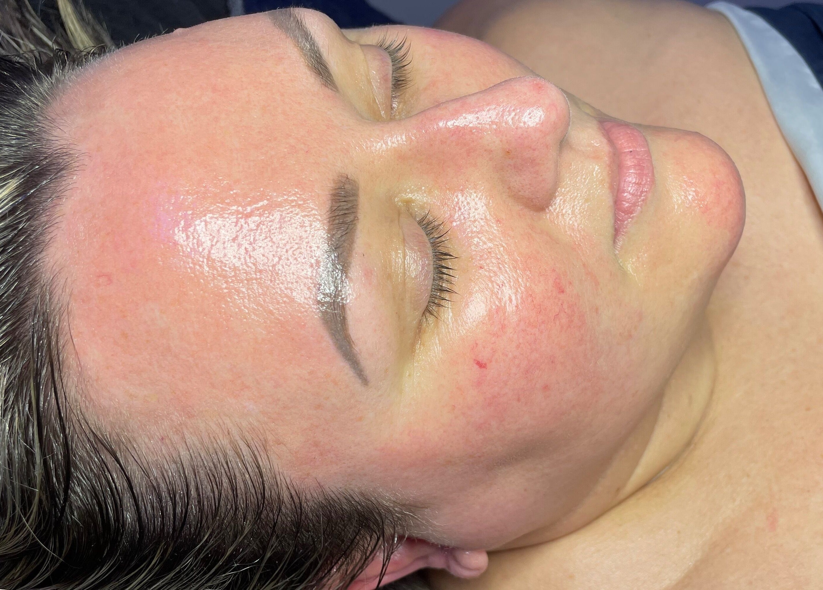 Close-up of a relaxed face glowing after treatment at Spasthetics, Newcastle-under-Lyme, England, GB.