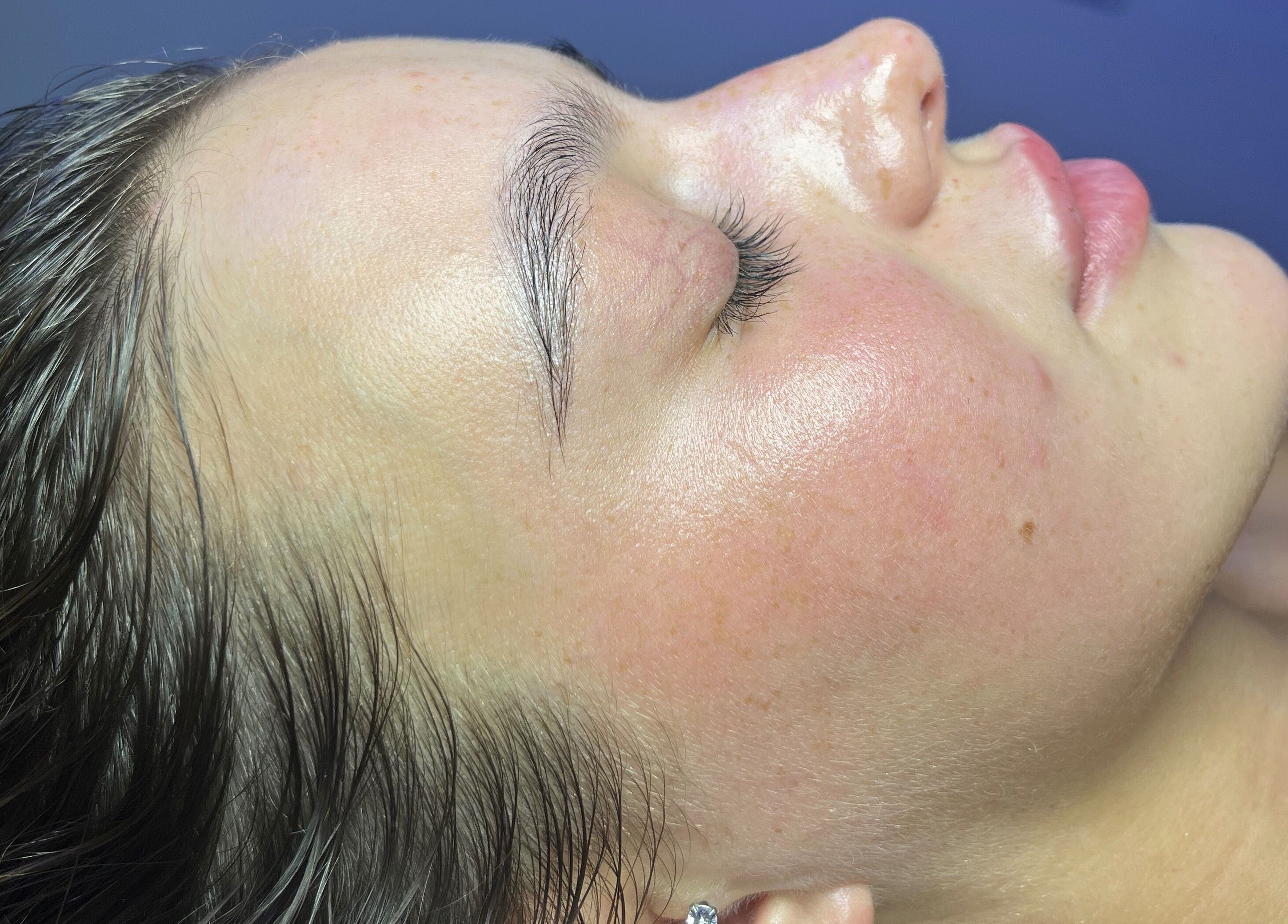 Close-up of woman with glowing skin after facial at Spasthetics, Newcastle-under-Lyme, England, GB.