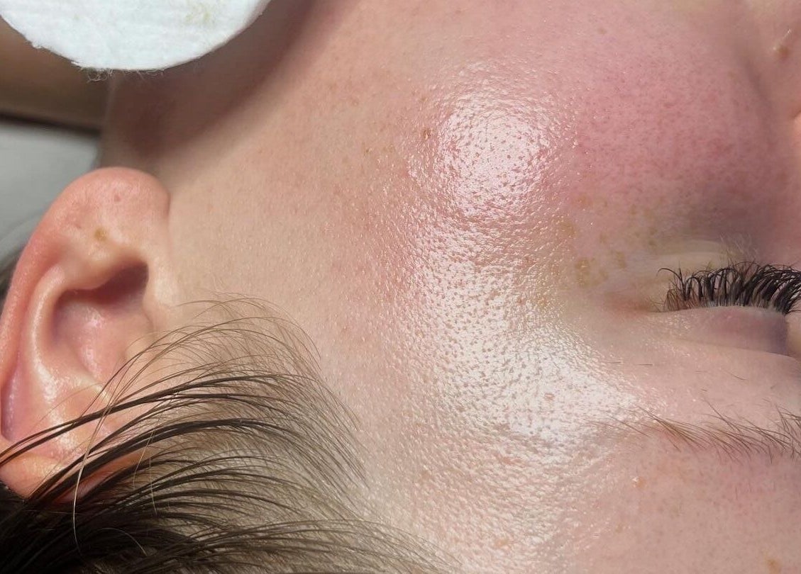 Close-up of a facial treatment at Spasthetics, Newcastle-under-Lyme, England, GB, highlighting smooth skin.