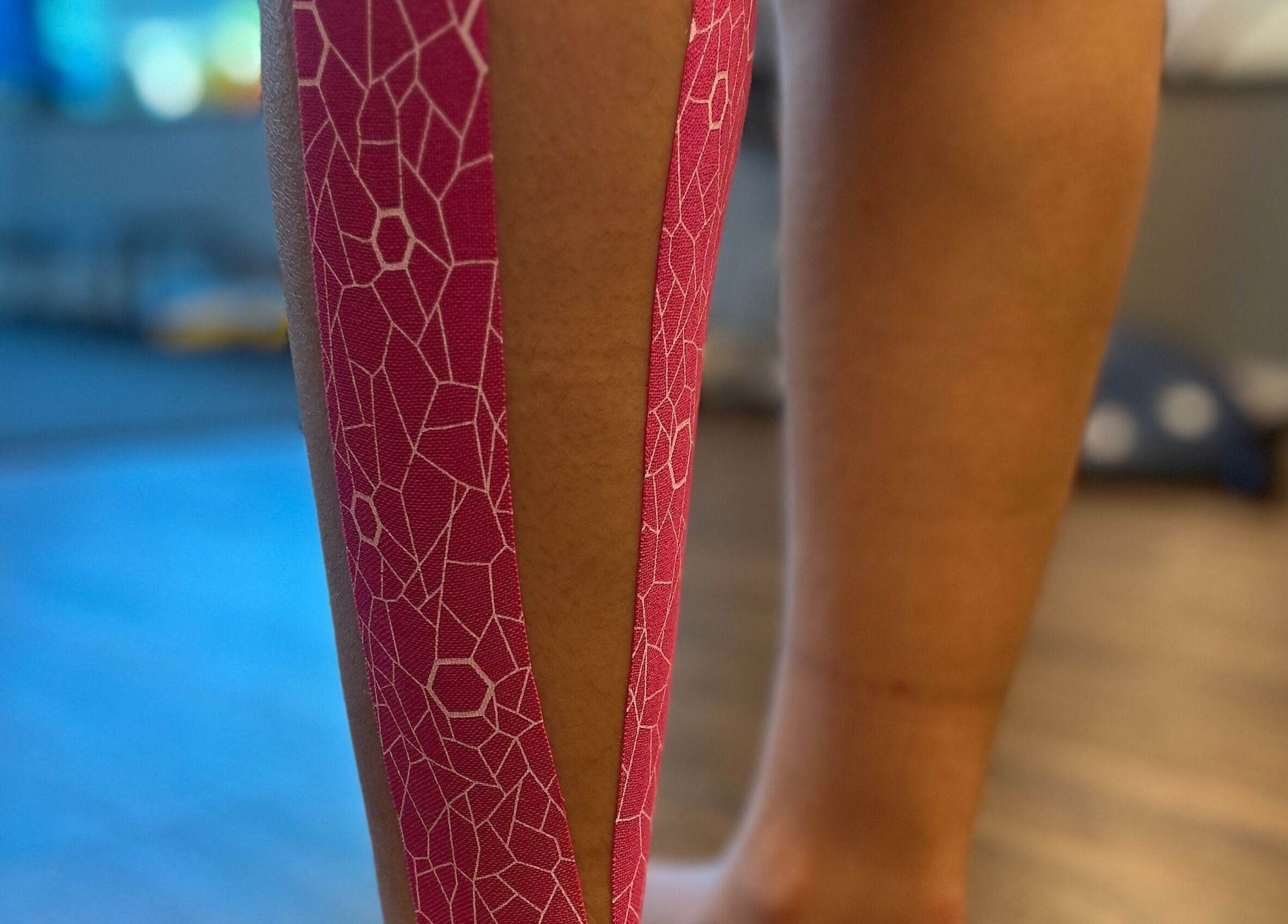 Cinta kinesiotape en pierna en Fisio Balance, Santiago De Los Caballeros, Santiago, DO.