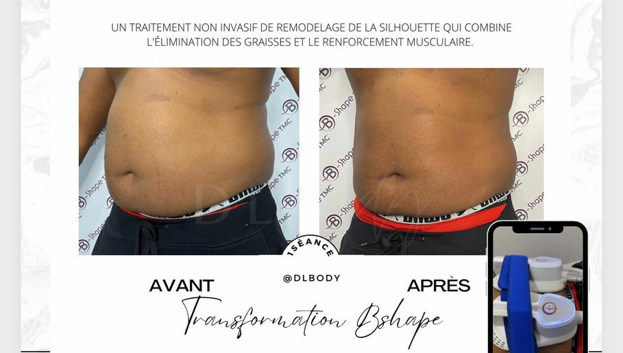 DL.BODY image 1