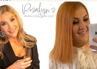 Before and after beauty at Rosalyn’s Medical Clinic, Wakefield, England, showcasing client transformations.