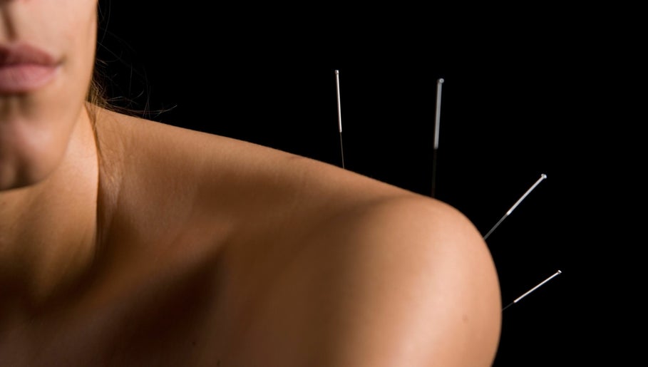 Kyla Phillips Acupuncture image 1
