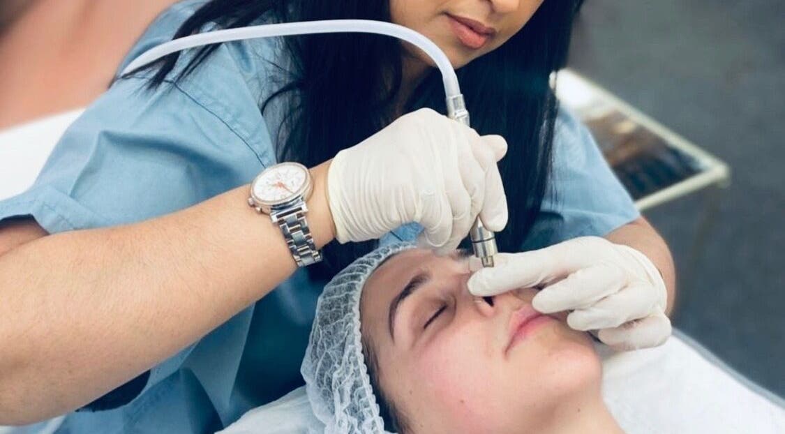 Facial treatment in progress at Aesthetic Skin Lab Ireland, Dublin, Dublin 15, IE.