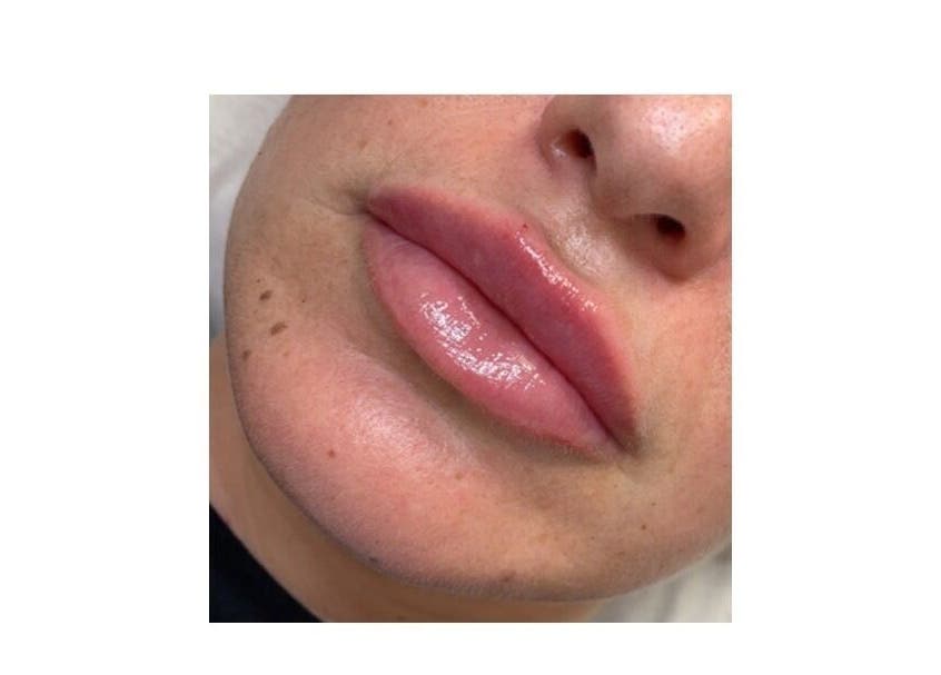 Close-up of glossy, enhanced lips at Dazzling Beauty & Aesthetics, Whitehead, Northern Ireland, GB.