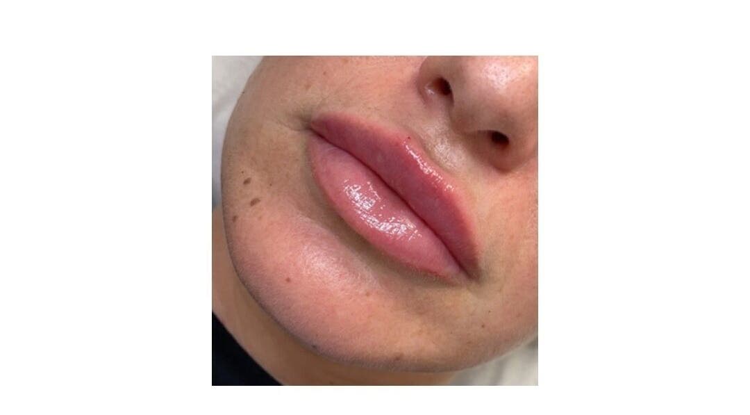 Close-up of glossy, enhanced lips at Dazzling Beauty & Aesthetics, Whitehead, Northern Ireland, GB.