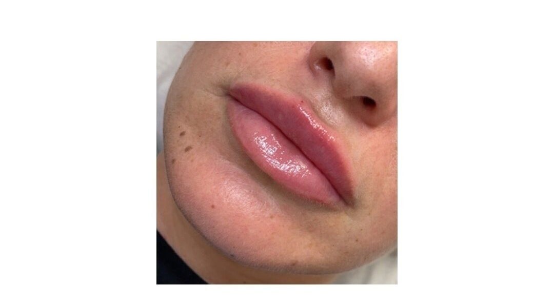 Close-up of glossy, enhanced lips at Dazzling Beauty & Aesthetics, Whitehead, Northern Ireland, GB.