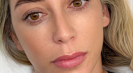 Close-up of woman's radiant complexion after beauty treatment at Blink Lab Studios, Singapore, SG.