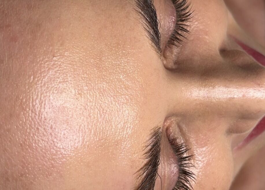 Close-up of a relaxed face with glowing skin at Advanced Therapeutic Clinic, Louth Village, County Louth, IE.