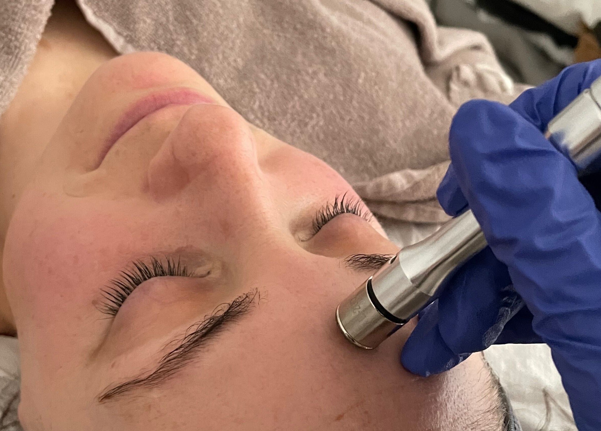 Facial treatment at Little Rest Skin Treatment Room, Birmingham, England, GB with a focus on radiant skincare.