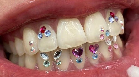 tooth Gems & custom Grillz - HOME image 3