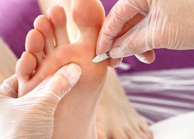 Professional foot treatment at MY FOOT CLINIC (Parkstone) in Poole, England, GB for healthy, beautiful feet.