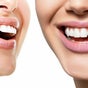 Illuminate Teeth Whitening