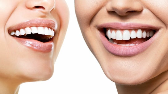 Illuminate Teeth Whitening