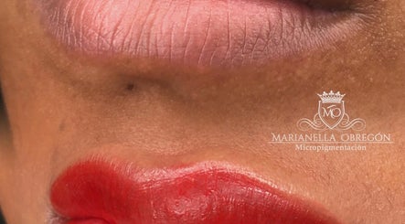 Marianella Obregón Anti-Aging and Micropigmentation Clinic – kuva 3