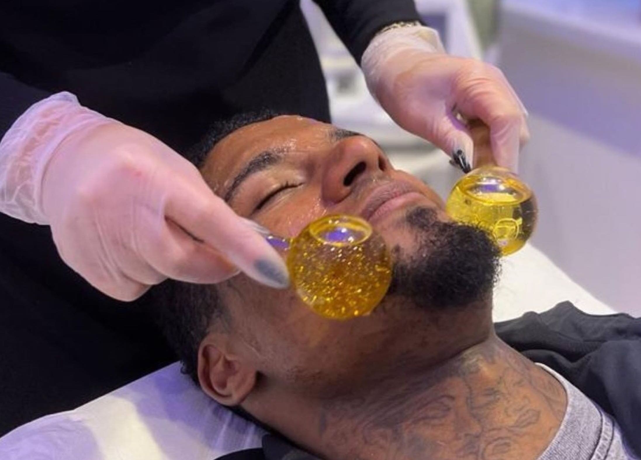 Facial treatment at Harley Skin and Laser, Stoke-on-Trent, England, GB, using golden glow spheres for radiance.