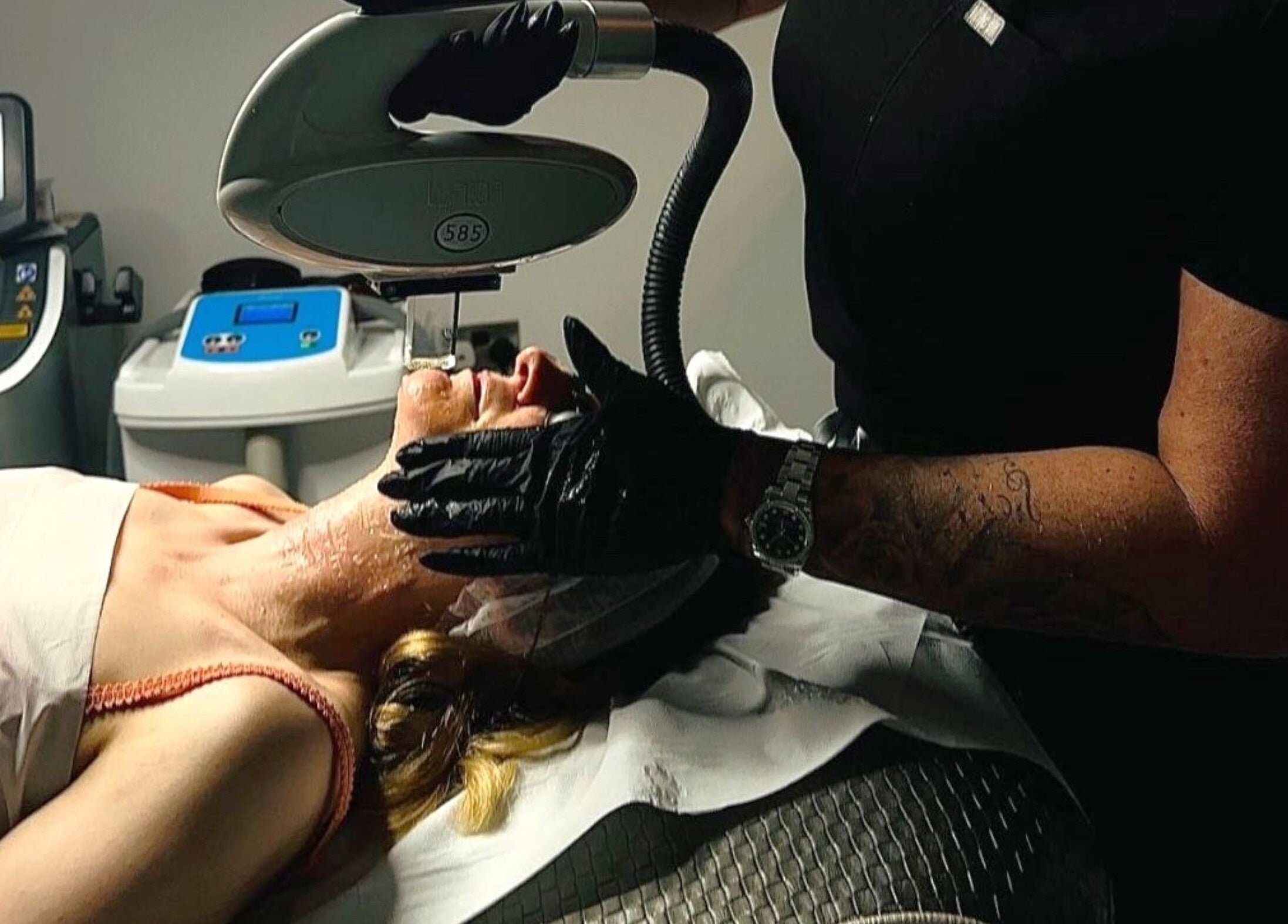 Professional laser skin treatment in progress at Harley Skin and Laser, Stoke-on-Trent, England, GB.