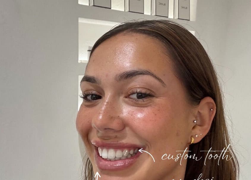 Bright smiling client at Blanc Salon | Teeth Whitening & Korean Lash Lifts, Surfers Paradise, Queensland, AU.