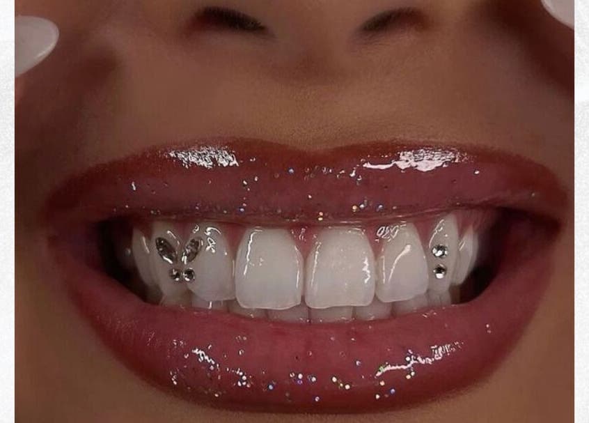 Close-up of chic tooth gems at Blanc Salon | Teeth Whitening & Korean Lash Lifts, Surfers Paradise, Queensland, AU.