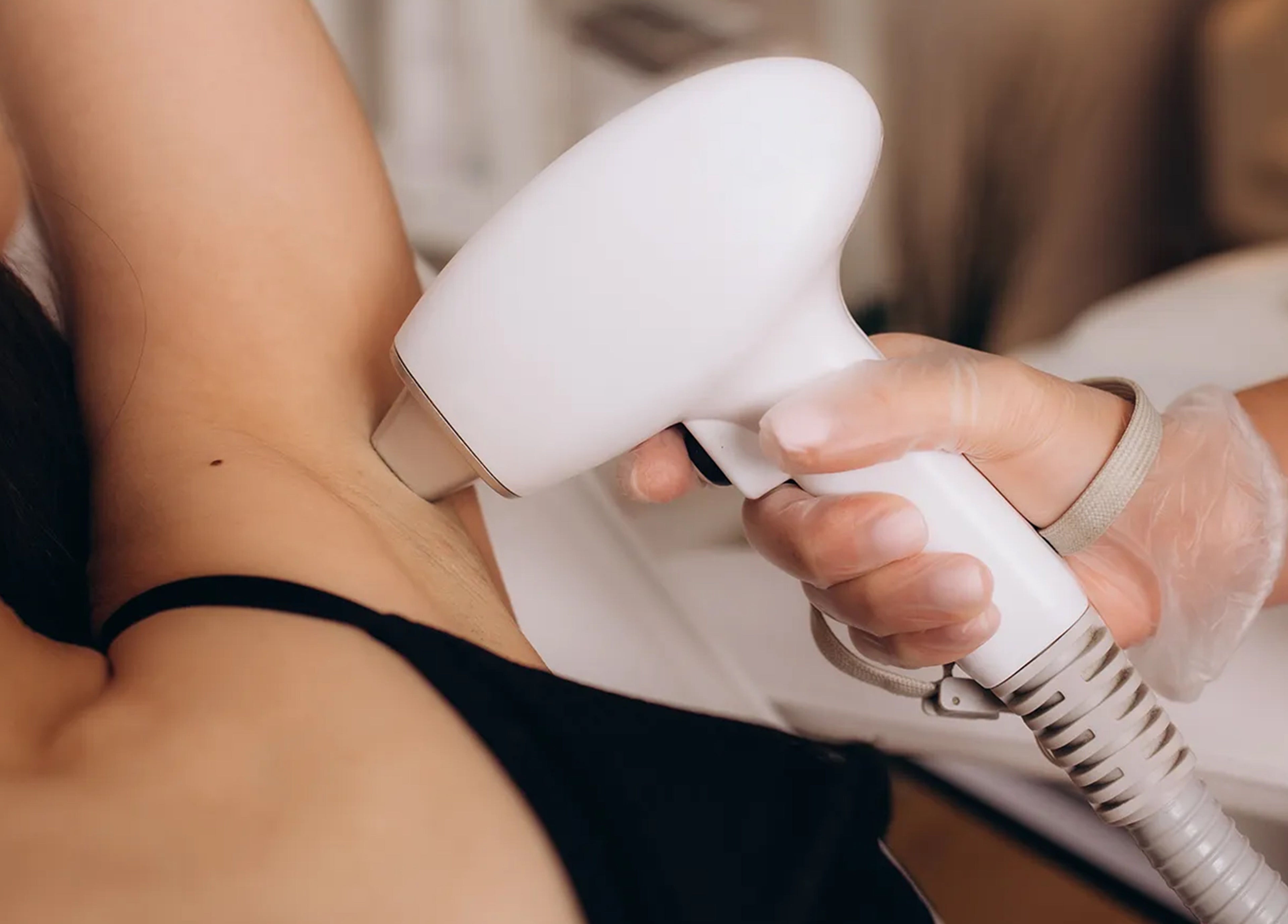 Bloom & Bare Roodepoort | Mobile Laser Hair Removal service in Roodepoort, Gauteng, ZA for underarm area.