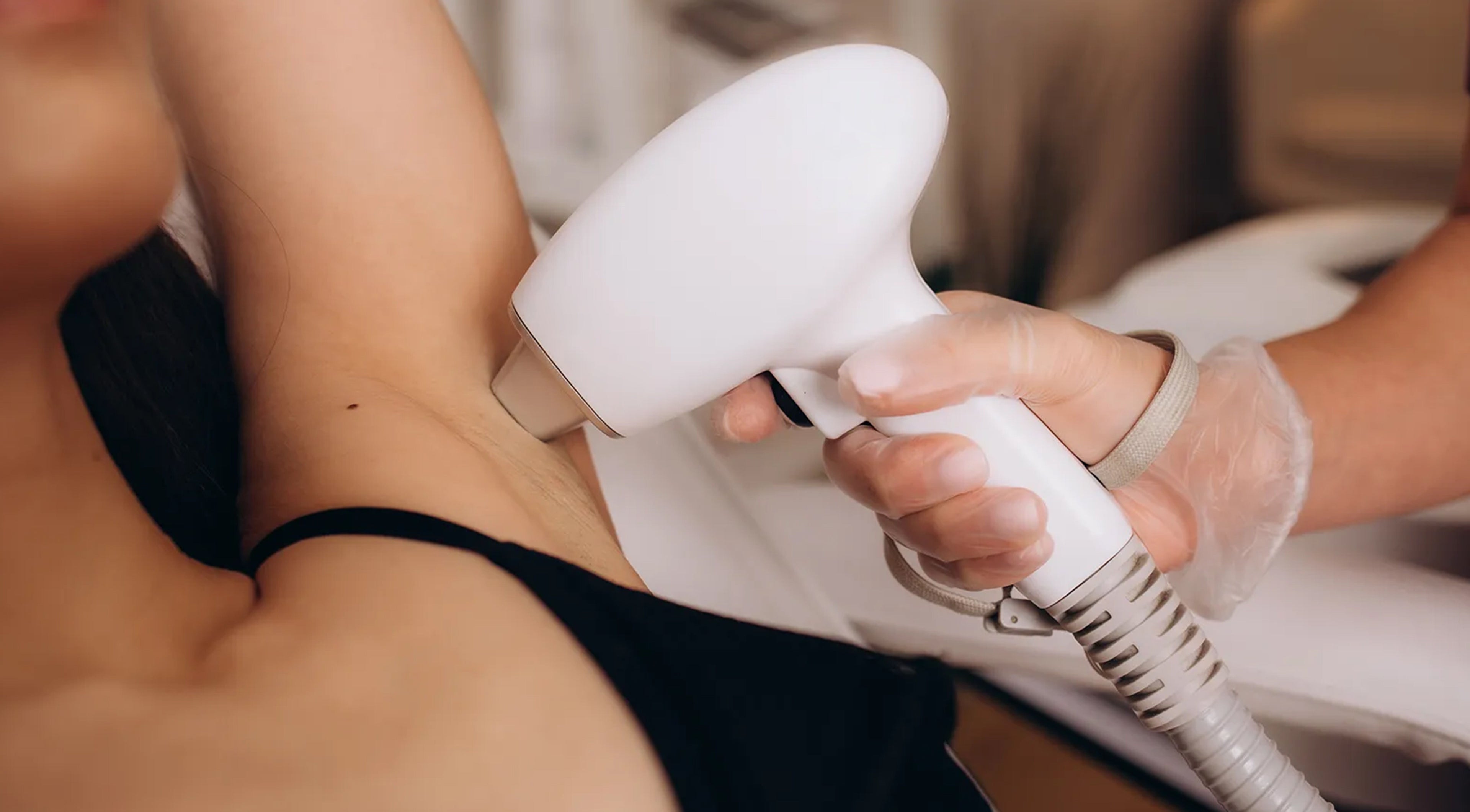 Bloom & Bare Roodepoort | Mobile Laser Hair Removal service in Roodepoort, Gauteng, ZA for underarm area.