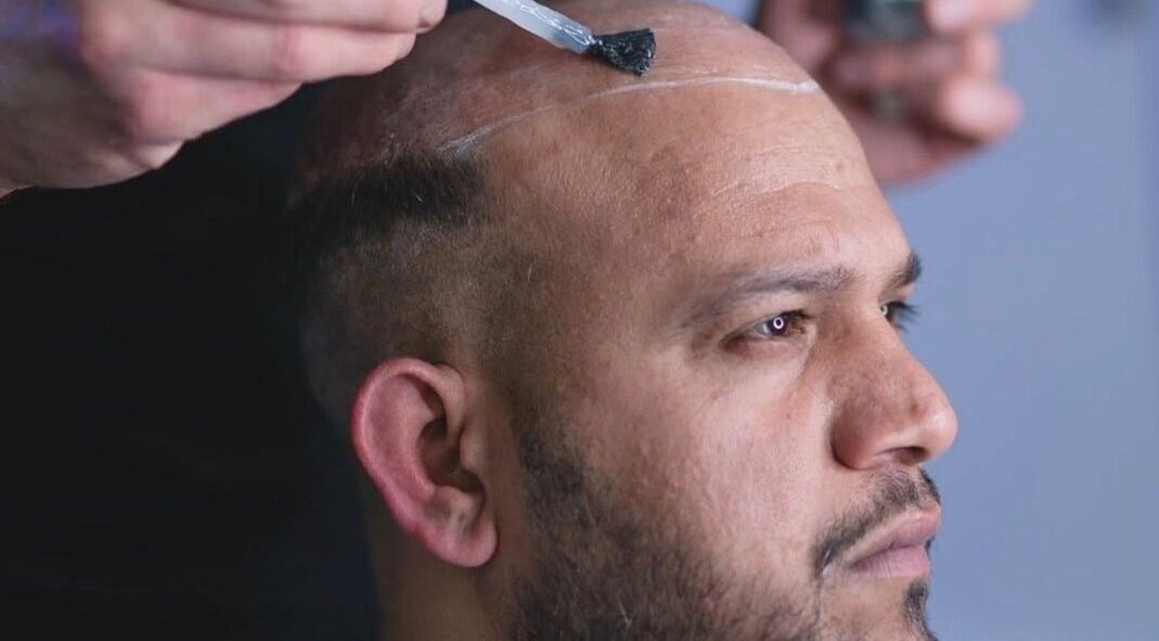 BROOKS Hair Tailoring - Hair Replacement Systems in Watford, England, GB offers expert hair application service.