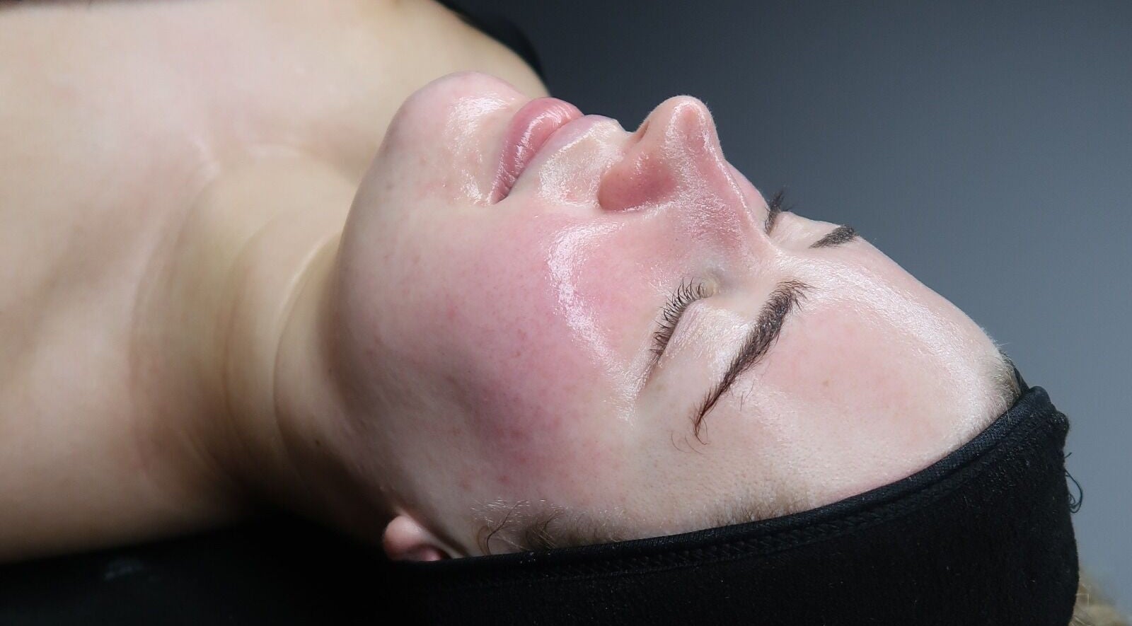Glowing skin treatment at Glass Skin Studio, Glasgow, Scotland, GB, showing a client's rejuvenated skin.