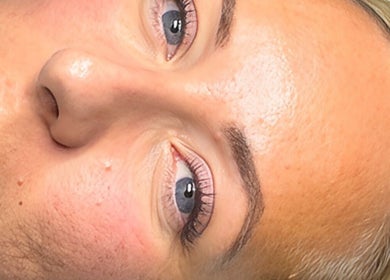Close-up radiant skin treatment at SLC Studio, Ash Green, England, GB showcasing elegant beauty.