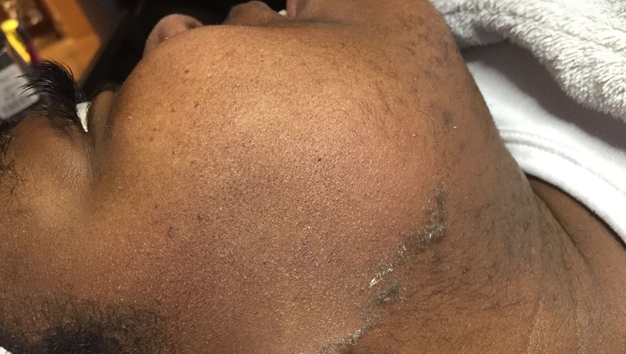 Soin visage à l'Institut L’impérial, Montréal, Québec, CA, peau apaisée sous serviette moelleuse.