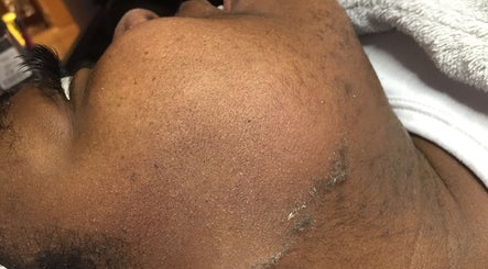 Soin du visage à l'Institut L'impérial, Montréal, Québec, CA, montrant une peau lisse et soignée.