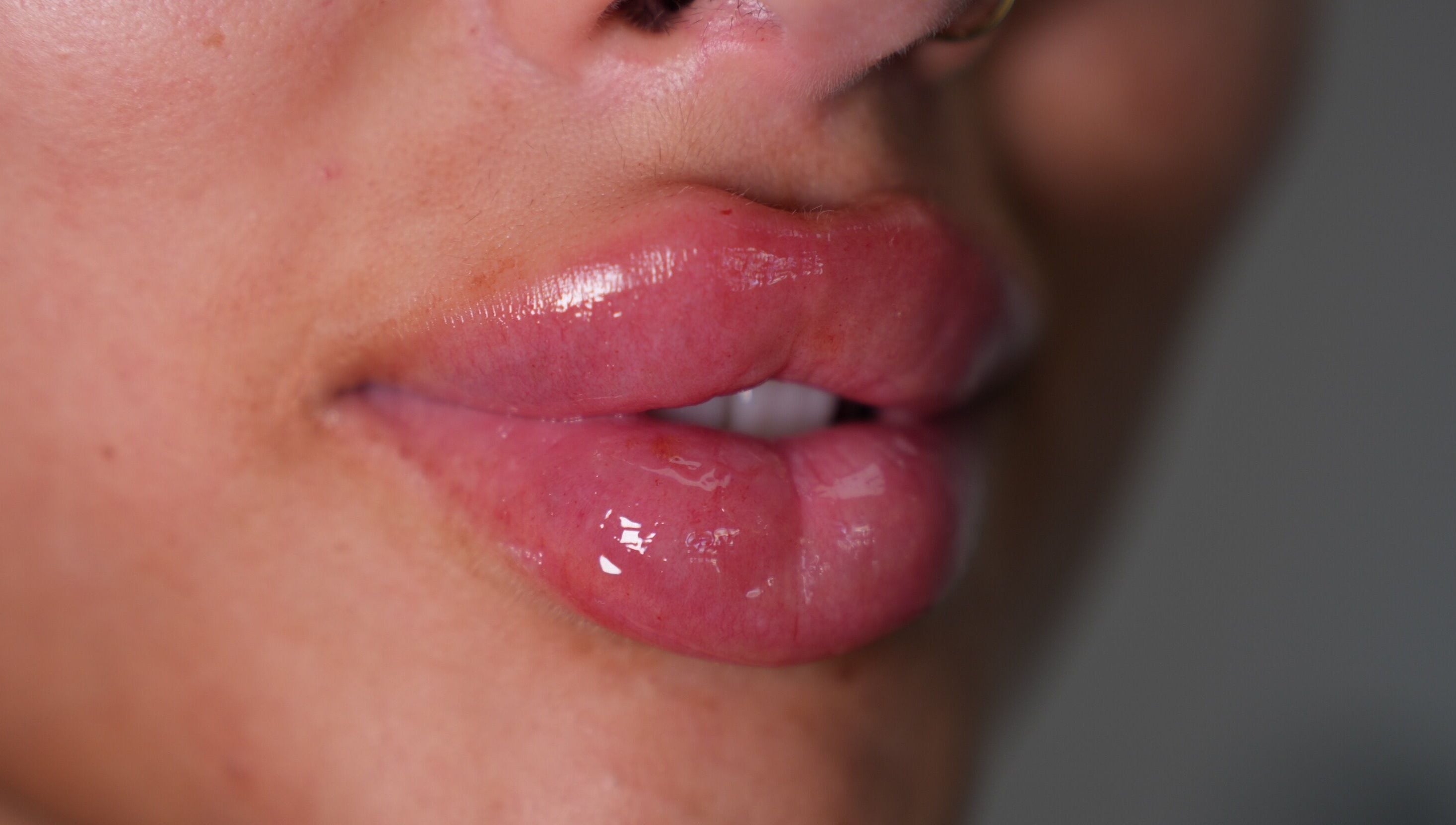 Close-up of glossy lips after treatment at Face by Demi, Hook, England, GB.