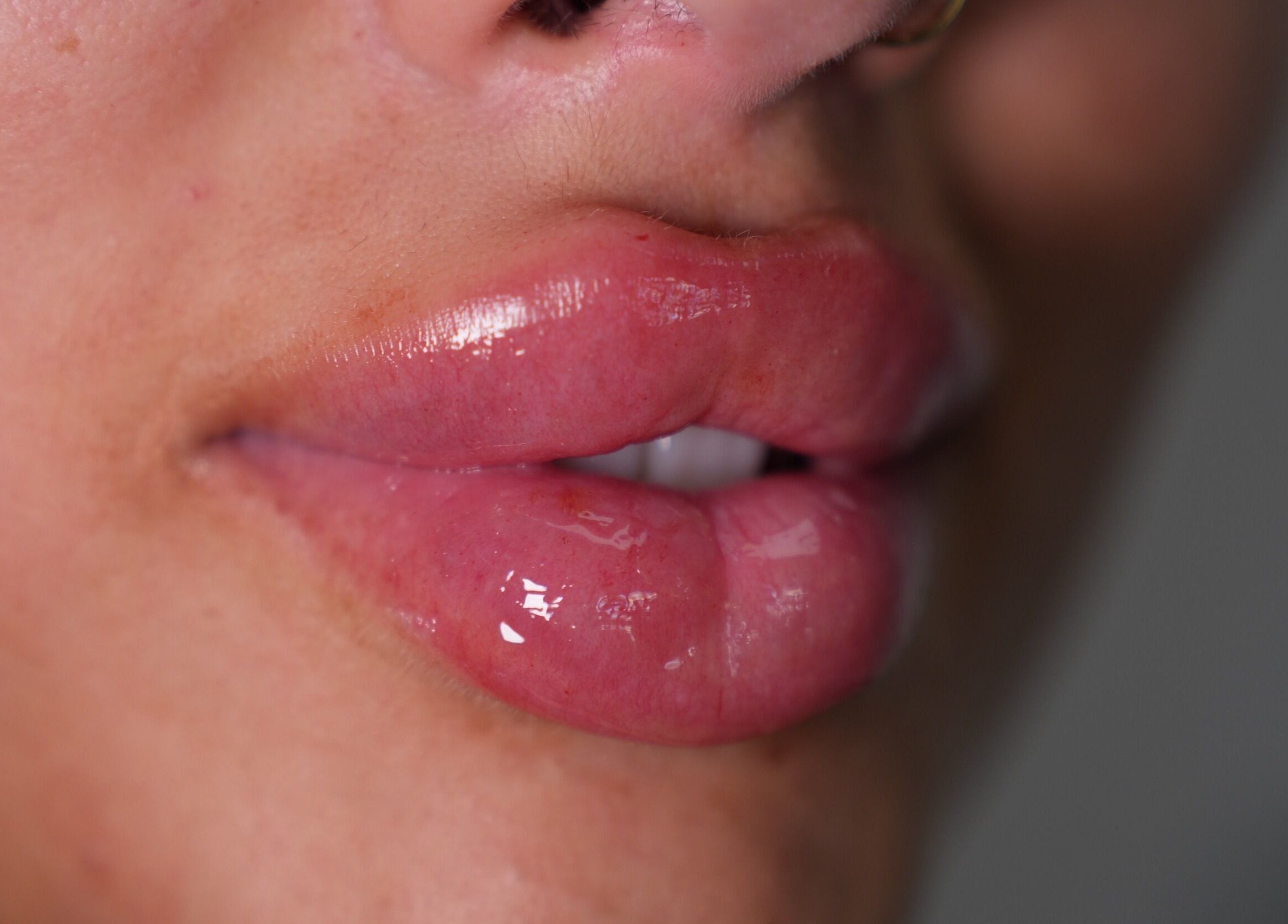 Close-up of glossy lips after treatment at Face by Demi, Hook, England, GB.