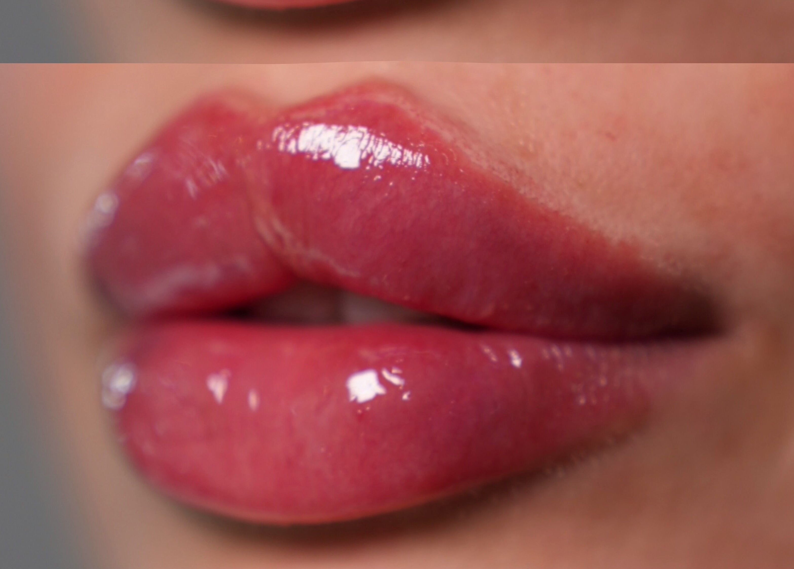 Close-up of glossy lips at Face by Demi in Hook, England, GB, showcasing expert lip enhancement.