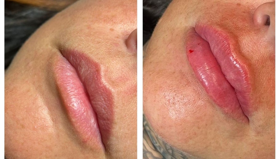 Precision Beauty image 1