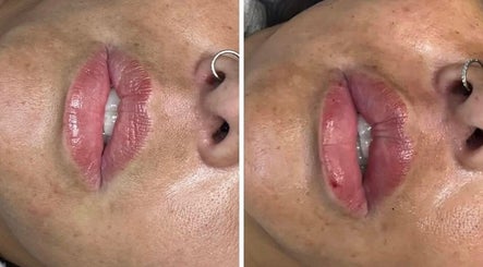Precision Beauty image 2