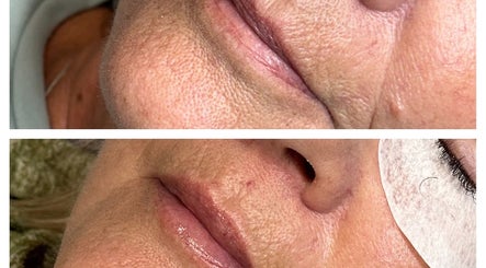 Precision Beauty image 3