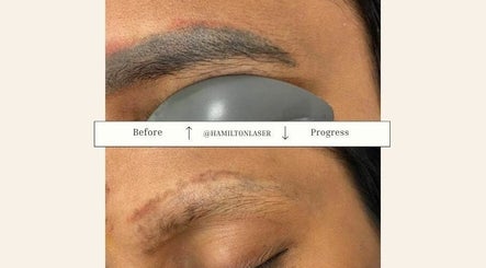 Hamilton Laser and Beauty Treatments зображення 3