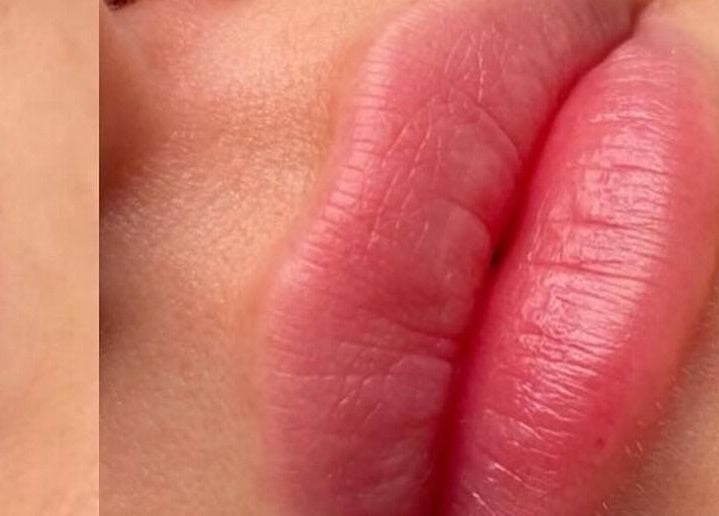 Closeup of beautifully colored lips at Rebalance Clinic and ITS Academy, New York, New York, US.