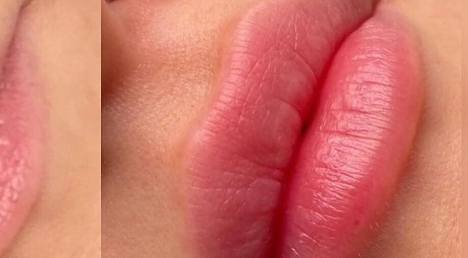 Closeup of beautifully colored lips at Rebalance Clinic and ITS Academy, New York, New York, US.
