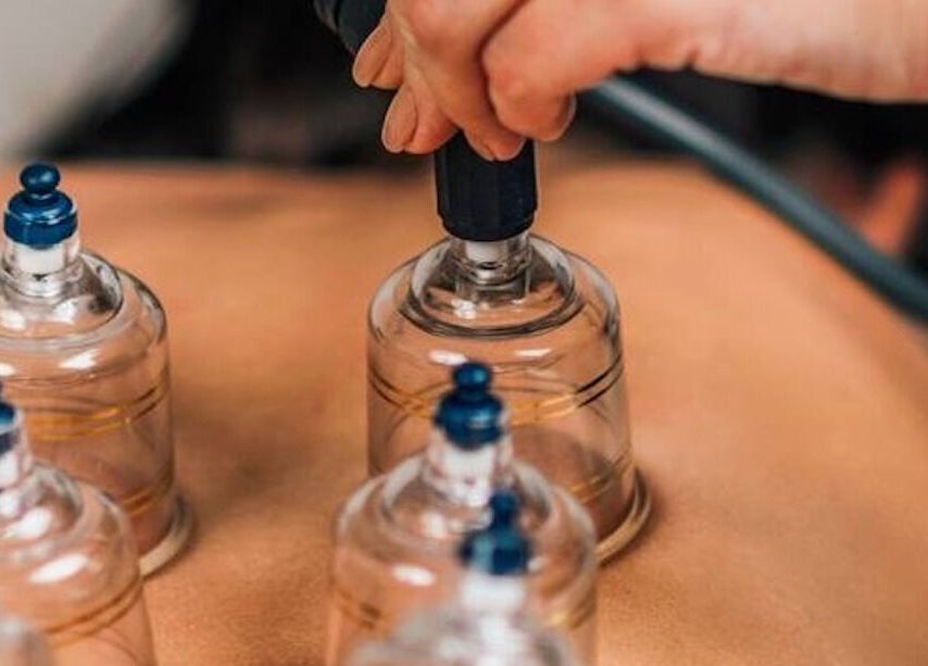 Cupping therapy session at The Little Gem Spa Massage, North Perth, Western Australia, AU.