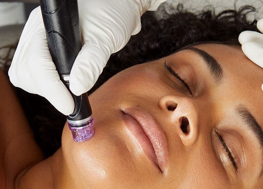 Facial treatment at The Skin Tune in Ramsey, New Jersey, US, enhancing skin with advanced dermatology techniques.