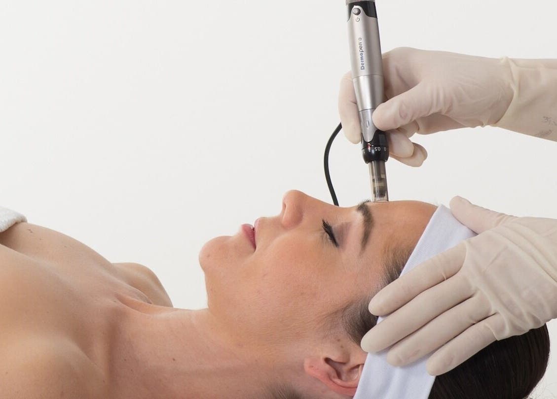 Microneedling at Halo Grooming Studio in Cape Town, Western Cape, ZA for rejuvenating skin care.
